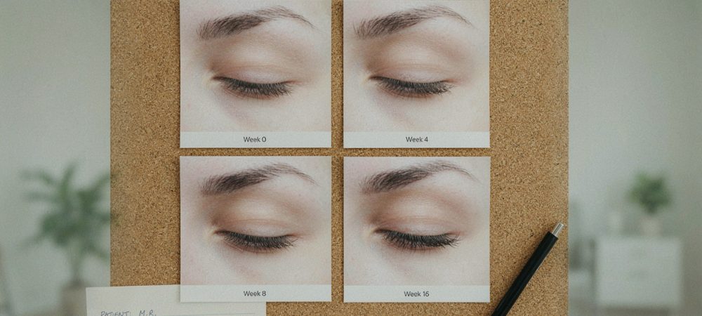 How Latisse Grows Longer Lashes Real Results Timeline