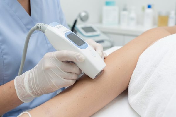 Laser Hair Removal Hurt