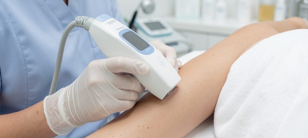 Laser Hair Removal Hurt